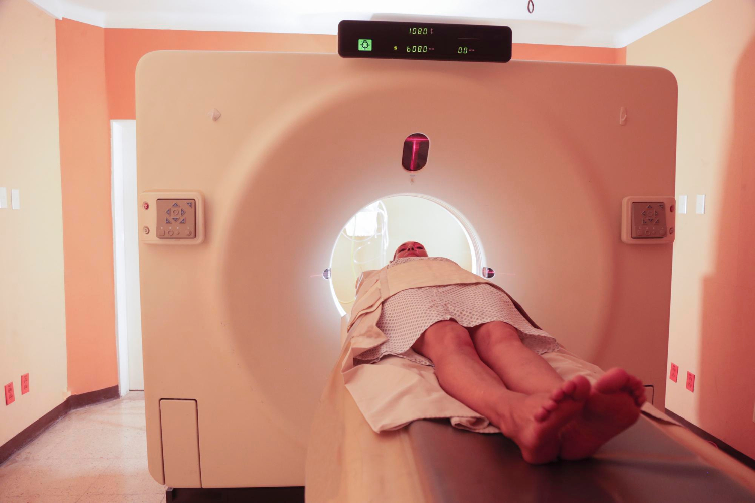 CT Coronary Angiography