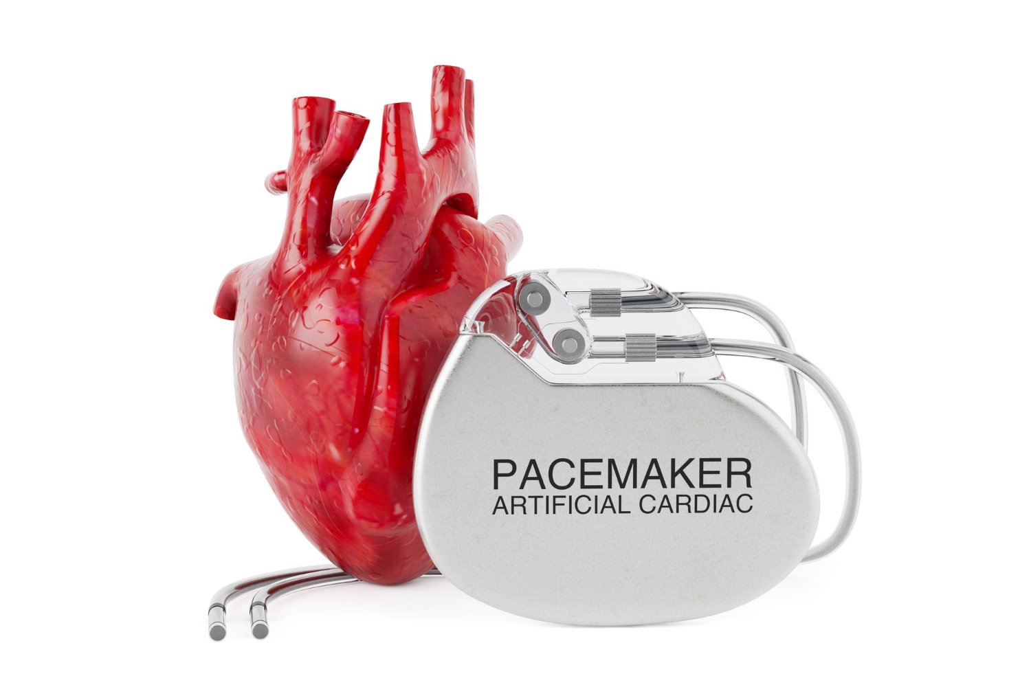 Pemasangan pacemaker dan ICD