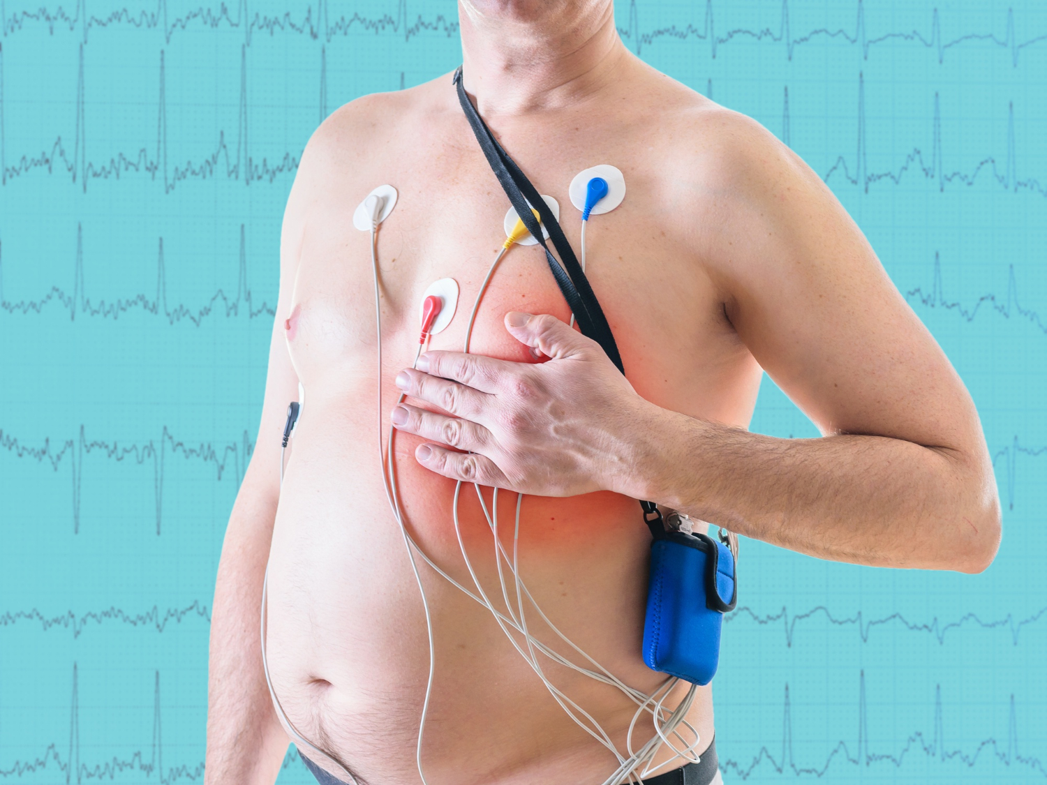 Holter Monitoring dan EKG