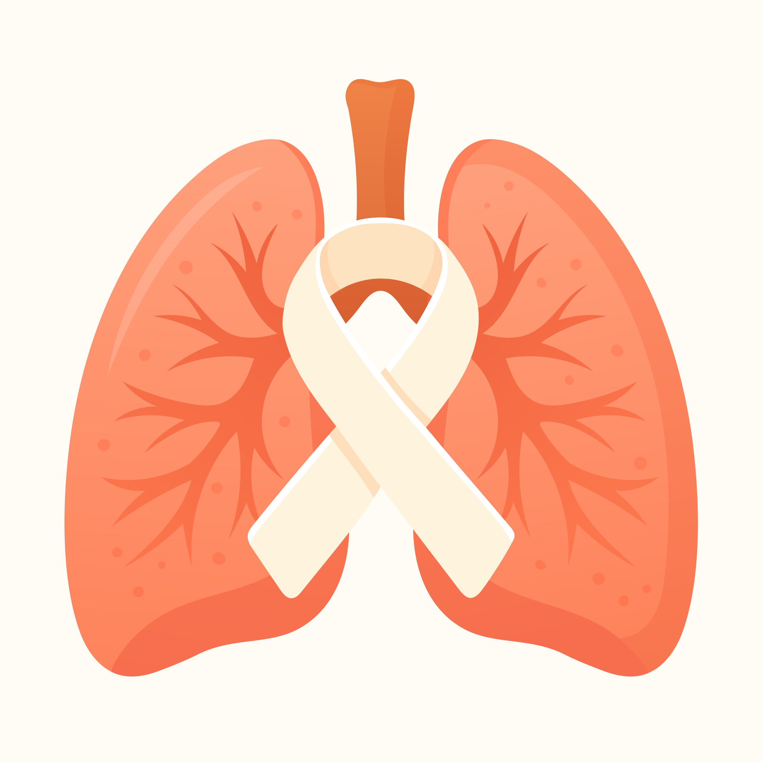 Kanker Paru-Paru - OPSI Medis