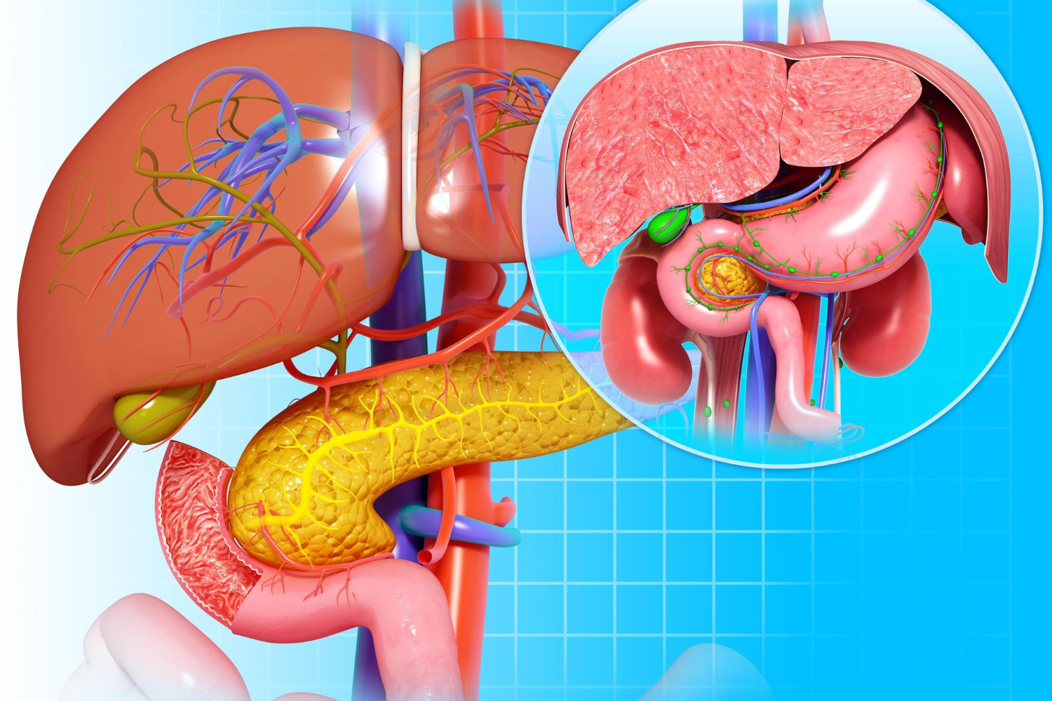 Kanker Pankreas - OPSI Medis