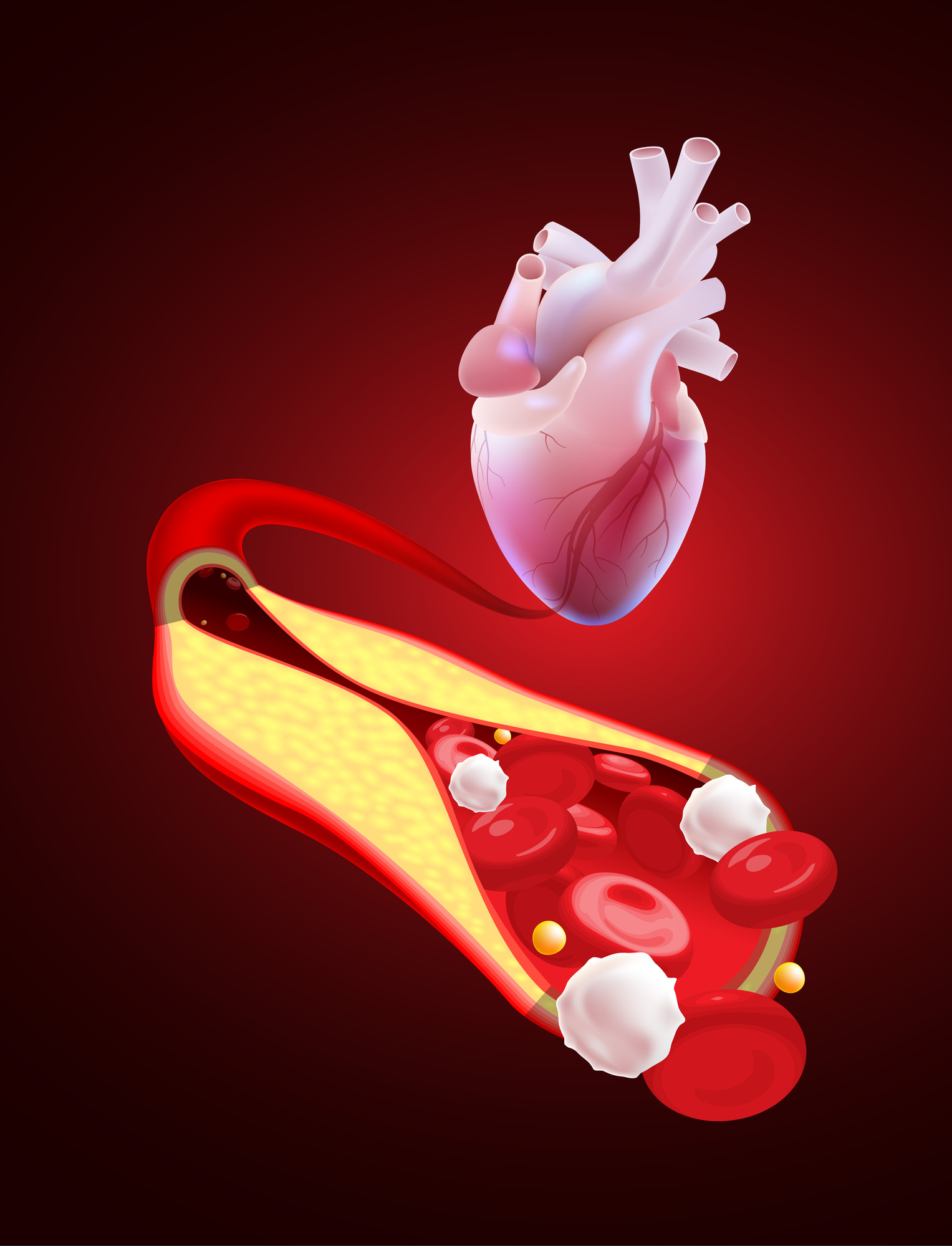 Hipertensi & Penyakit Jantung