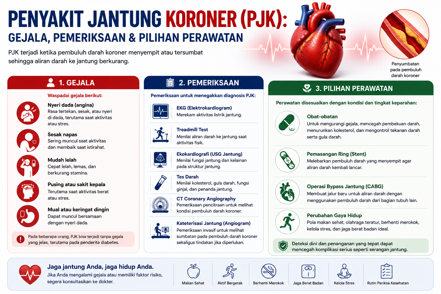 Penyakit jantung koroner (PJK) — penyempitan arteri koroner akibat penumpukan plak